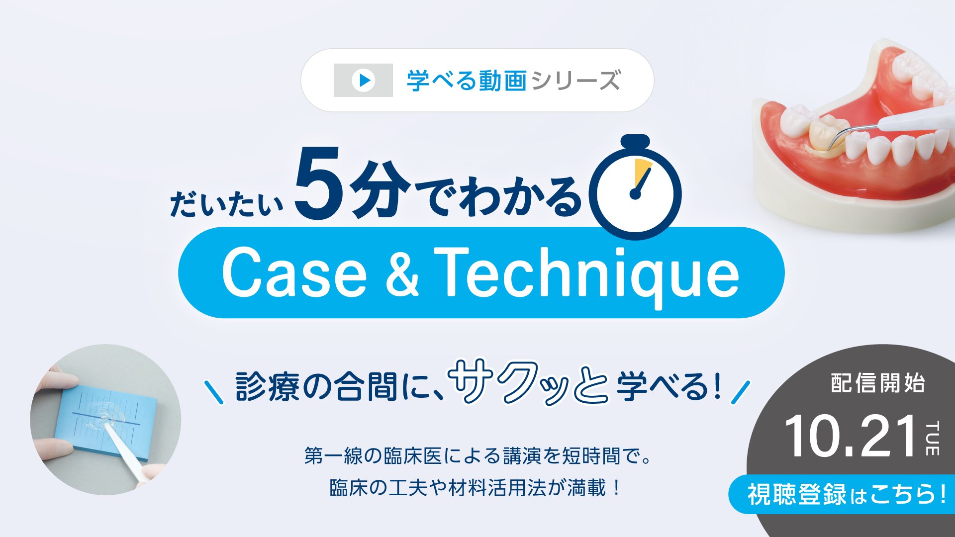 だいたい5分でわかる Case & Technique