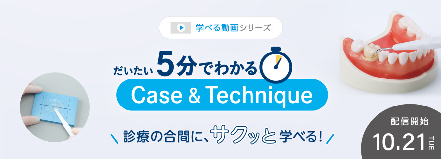 だいたい５分でわかる Case & Technique