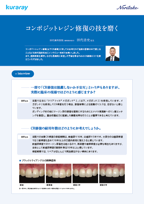 田代浩史先生 コンポジットレジン修復の技を磨 （学術・臨床情報）